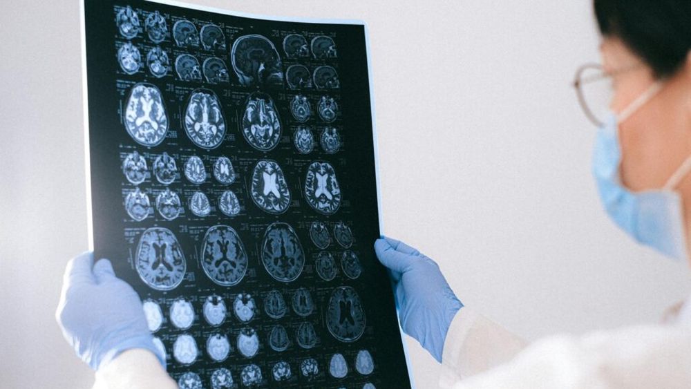 Un neurolog a spus ce mănâncă aproape zilnic la prânz pentru a preveni apariția bolii Alzheimer