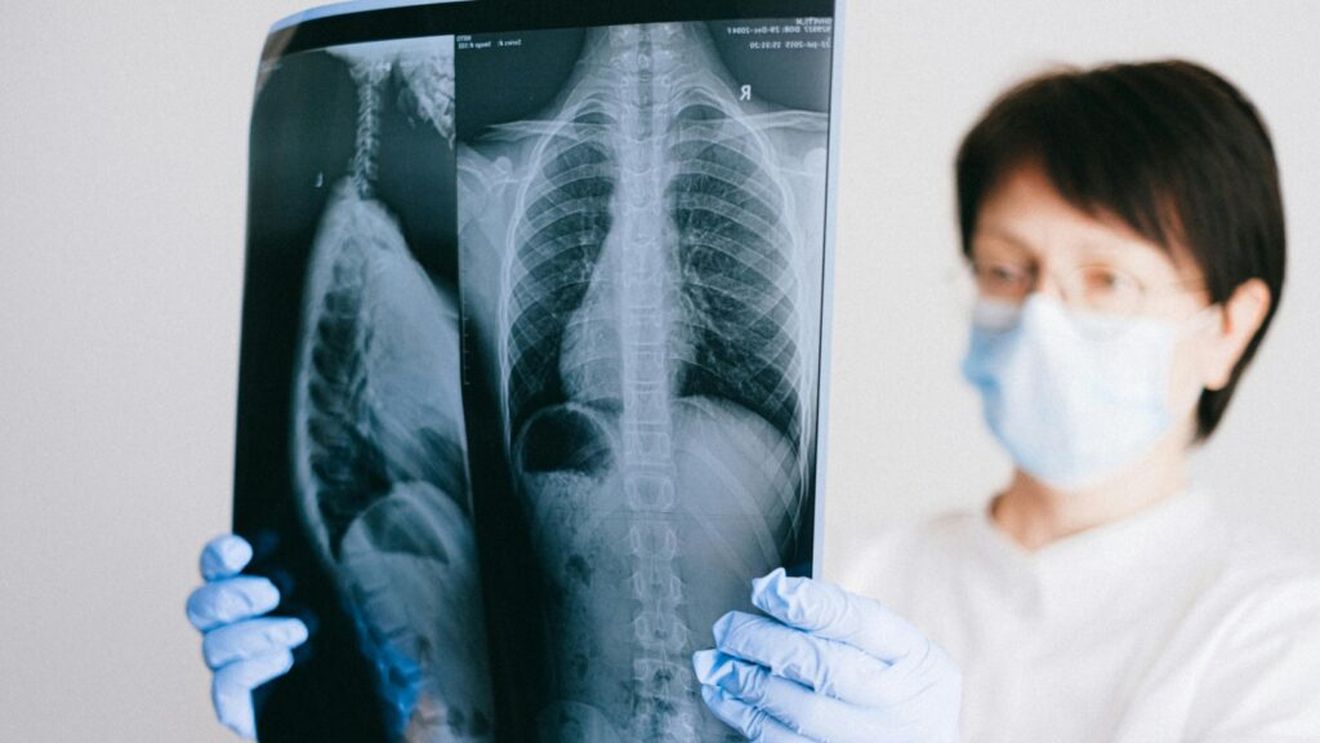 Datele arată că 1 din 16 oameni va fi diagnosticat cu cancer pulmonar / Factorii de risc principali – fumatul intensiv, consumul de alcool şi cafea / Dr. Beatrice Mahler ne spune ce să facem pentru a depista boala din timp