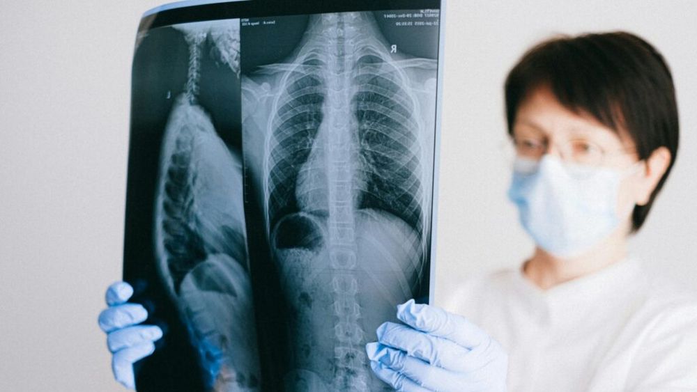 Datele arată că 1 din 16 oameni va fi diagnosticat cu cancer pulmonar / Factorii de risc principali – fumatul intensiv, consumul de alcool şi cafea / Dr. Beatrice Mahler ne spune ce să facem pentru a depista boala din timp