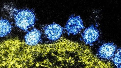 Cum rupe epidemia de coronavirus lanțurile alimentare internaționale