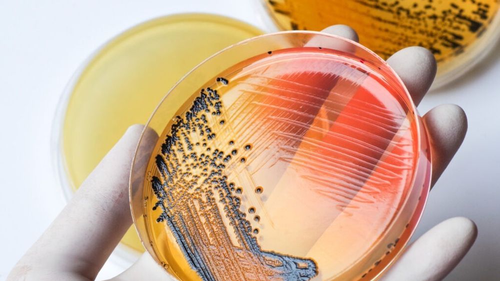 Rezultatele DSVSA Bihor arată că alimentele servite la hotelurile din Băile Felix nu au provocat problemele digestive ale copiilor participanți la turneul de fotbal