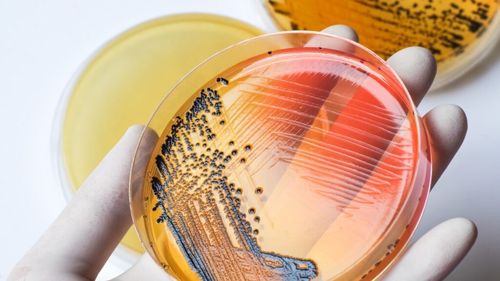 Rezultatele DSVSA Bihor arată că alimentele servite la hotelurile din Băile Felix nu au provocat problemele digestive ale copiilor participanți la turneul de fotbal