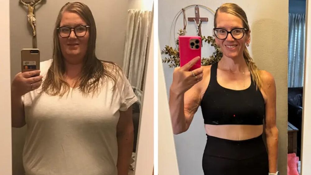 O femeie a slăbit 86 de kilograme schimbând dieta, făcând mișcare și luând „Ozempic”. E surprinzător cât au contribuit medicamentele și cât stilul de viață