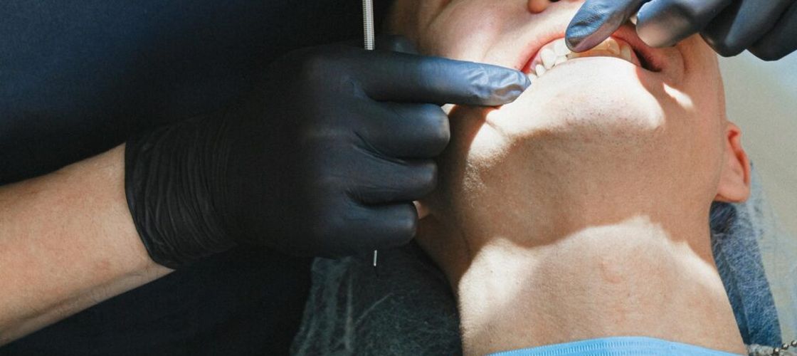 Cardiolog: „Dacă nu te speli pe dinți, poți ajunge să ai o infecție la inimă”/ Legătura între resturile alimentare și afecțiunile corpului