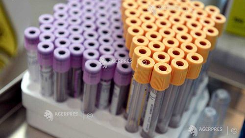 Atenție! ANF a lansat Programul național de monitorizare a reziduurilor de pesticide pentru anul 2020