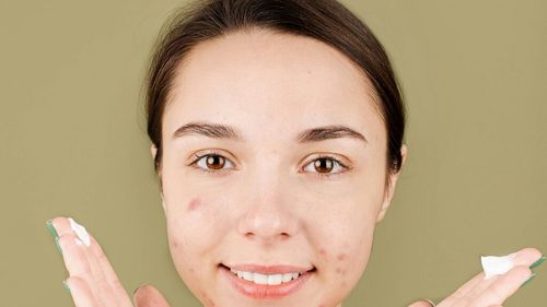 Dieta care te scapă de acneea hormonală: Dacă mănânci cereale integrale, ouă, somon, sardine, broccoli sau avocado vei putea gestiona erupțiile / Evită lactatele, dulciurile rafinate, alimentele procesate și excesul de cafea și alcool, pentru că agravează acneea