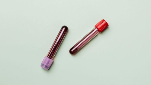 Ce trebuie să mănânci după ce ți s-a luat sânge/Alimentele bogate în fier și vitamine din grupul B sunt ideale