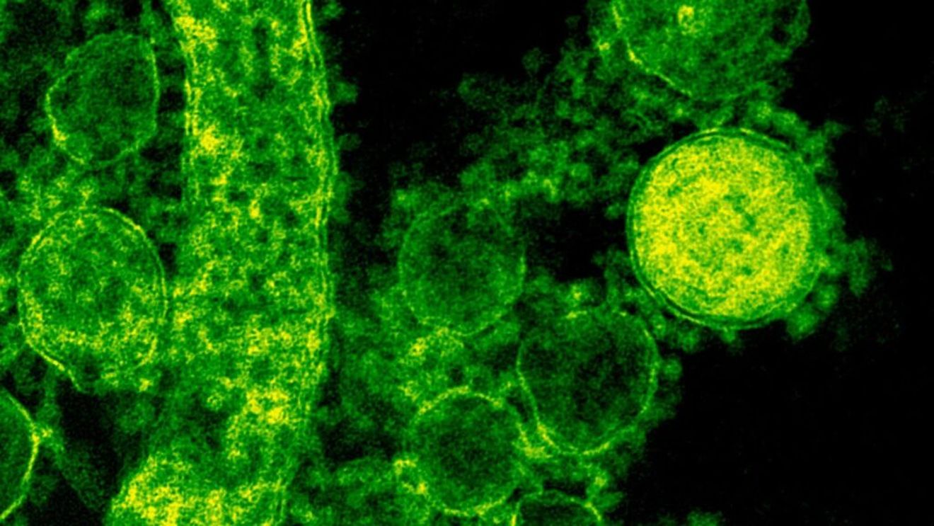 Noile Tehnici Genomice, discutate pentru a doua oară în cadrul unui trilog european ( Parlament, Comisie, Consiliu ) / Divergențe privind brevetarea și etichetarea plantelor obținute prin editare genetică