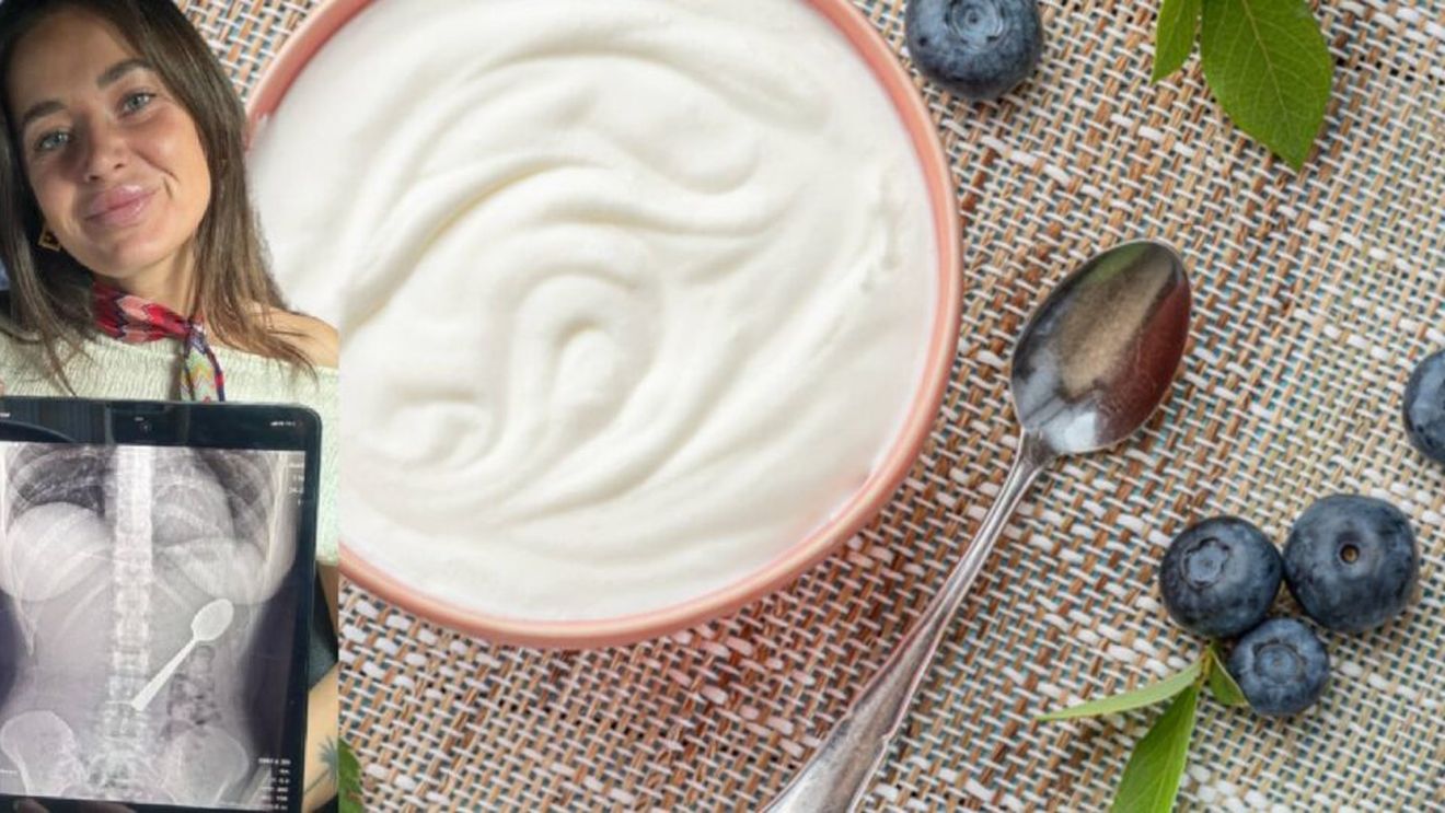 O femeie de 28 de ani a înghițit accidental o lingură de 17 cm în timp ce mânca iaurt / Motivul pentru care a ținut totul secret