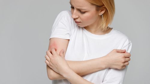 Societatea Română de Dermatologie: Alimentația și poluarea au dus la creșterea numărul de pacienți cu dermatită atopică