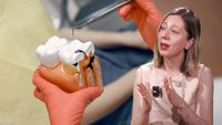 VIDEO | De ce apar cariile și bolile gingiilor / Dr. Mariana Cărămidă: „Alimentele cu un conținut crescut de zahăr fermentează în contact cu bacteriile din cavitatea bucală. Această fermentație produce aciditate, iar aciditatea este cea care demineralizează dinții”
